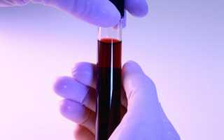 Группа крови 2 отрицательная — характеристика, особенности, рекомендации