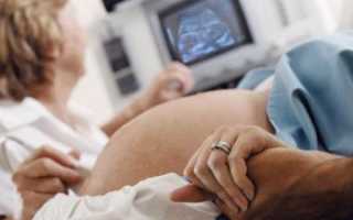 УЗИ сердца плода при беременности: кому показано, нюансы проведения