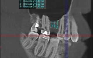 Конусно-лучевая компьютерная томография — инновационный метод исследования патологий челюстно-лицевой области