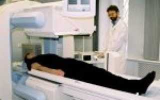 Вреден ли рентген: опасное влияние на организм человека, последствия для здоровья