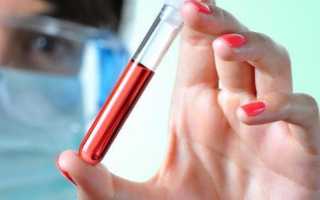 Значение повышенного содержания лимфоцитов в крови у ребенка