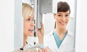 Внеротовая рентгенография, Внутриротовая рентгенография – Рентген в стоматологии