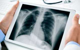 Как после рентгена можно вывести радиацию из организма