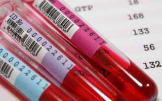 PLT в анализе крови: расшифровка у взрослых и детей